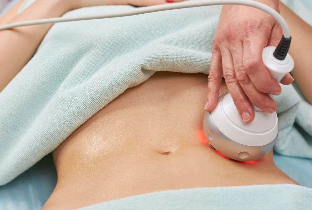 Procedimento de radiofrequência corporal para redução de gordura localizada abdominal e firmeza da pele